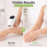 IPL Laser Hair Removal Device – Permanent Hair Reduction (UK White)