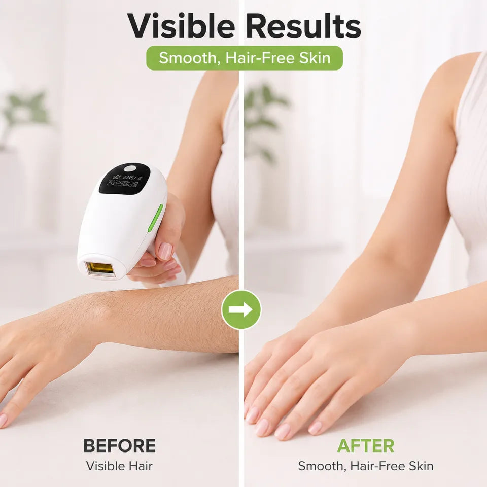IPL Laser Hair Removal Device – Permanent Hair Reduction (UK White)
